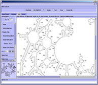 XRNA